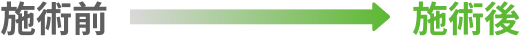 施術前・施術後