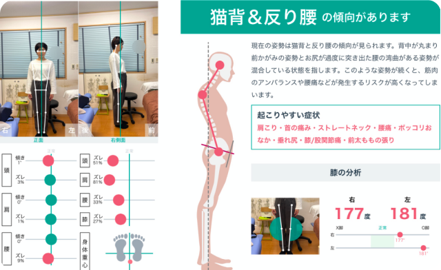 施術後姿勢分析