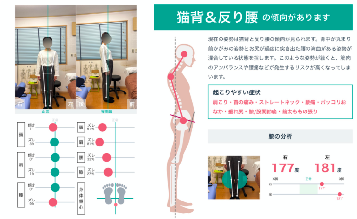 AI姿勢分析レポートで現状を見える化