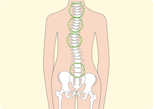 腰痛の本当の原因は「背骨のゆがみ」