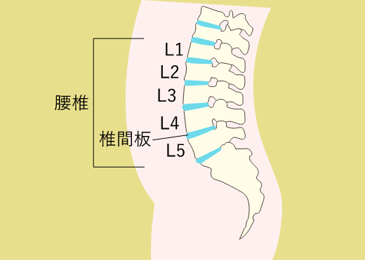 反り腰の本当の原因は「2つの骨のゆがみ」